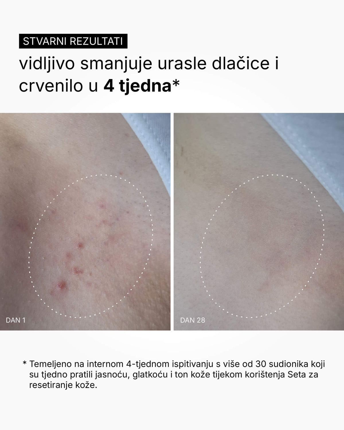Zestaw Odnowy Skóry - Rutyna do całego ciała