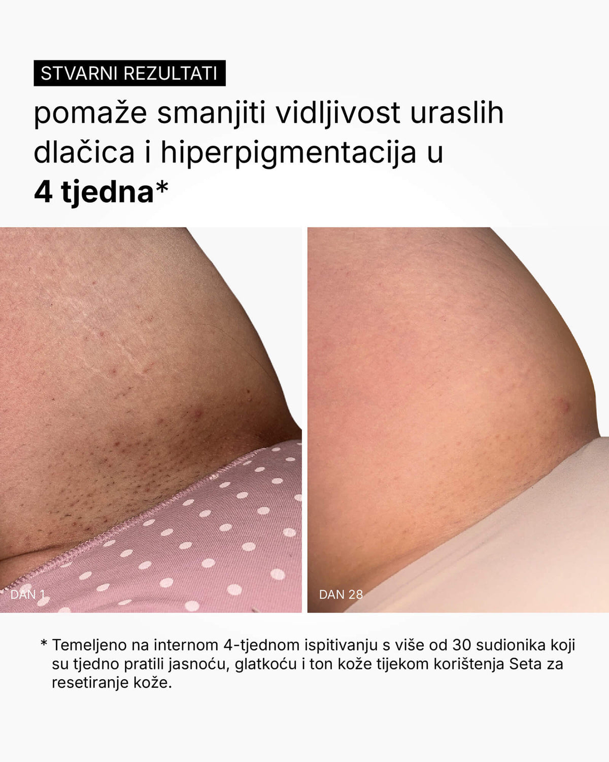 Zestaw Odnowy Skóry - Rutyna do całego ciała