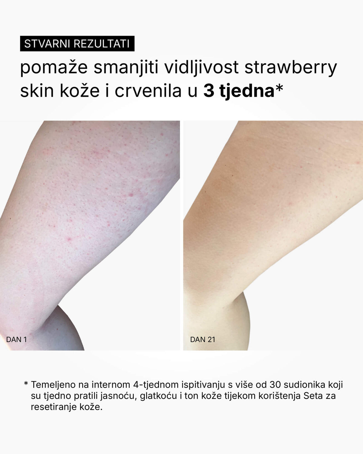 Zestaw Odnowy Skóry - Rutyna do całego ciała