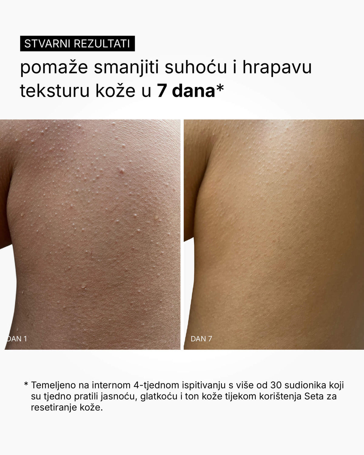 Zestaw Odnowy Skóry - Rutyna do całego ciała
